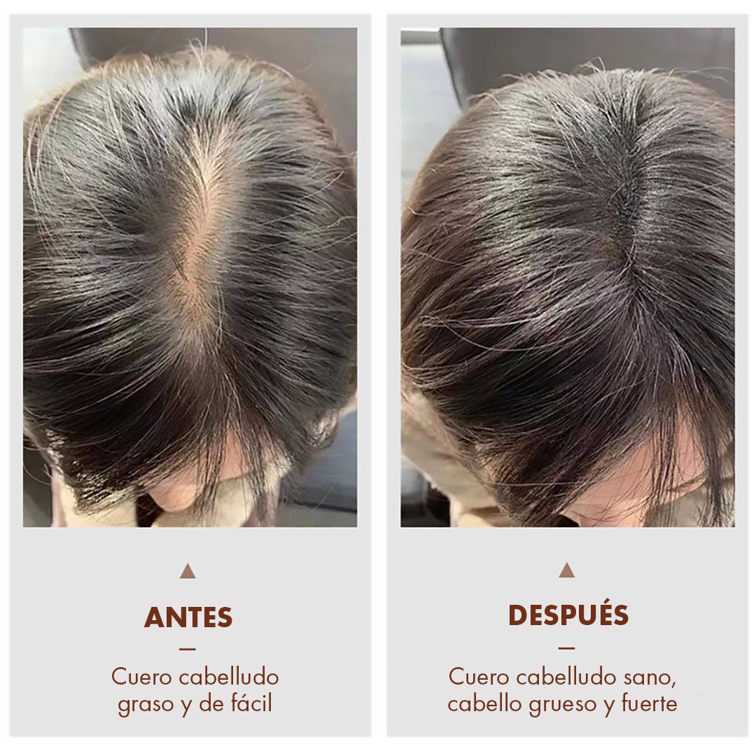 Set Tratamiento Anticaída Jengibre y Ginseng